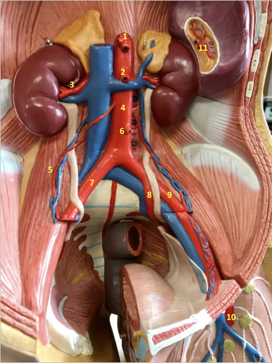 <p>Abdomen/Pelvis</p><p>1. Celiac artery</p><p>2. Superior mesenteric artery</p><p>3. Right renal artery</p><p>4. Abdominal aorta</p><p>5. Right gonadal artery</p><p>6. Inferior mesenteric artery</p><p>7. Right common iliac artery</p><p>8. Left internal iliac artery</p><p>9.Left external iliac artery</p><p>10.Left femoral artery</p><p>11. Splenic artery</p>