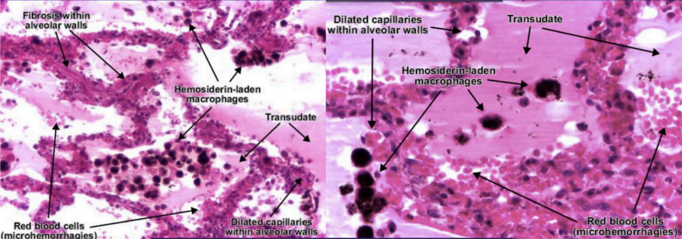 <p>Identify</p>