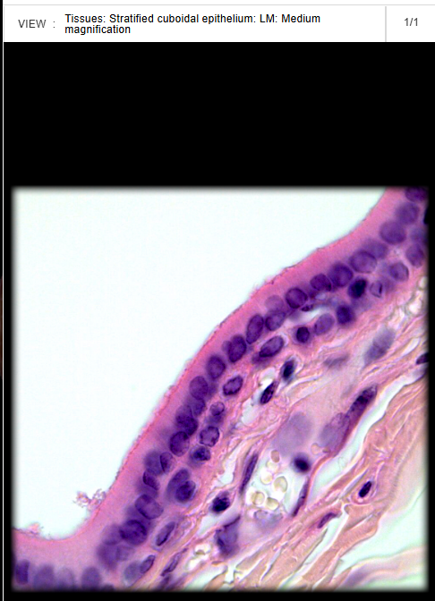 <p><span>Parotid duct</span></p>