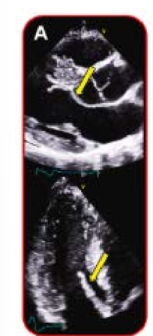 <p>what does this image show?</p>