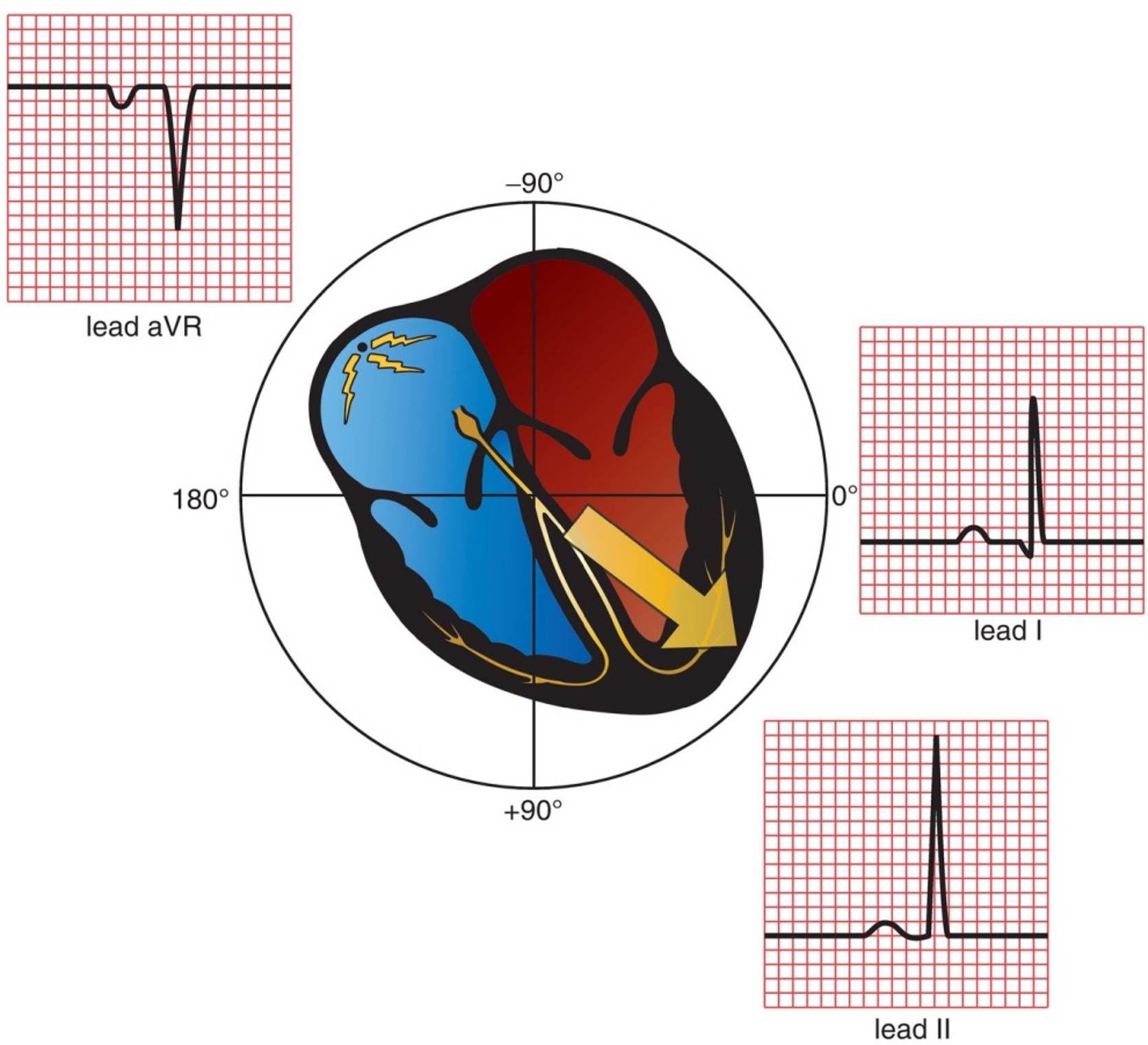 <p>Left Lateral Leads (I, aVL, V5, V6) and Inferior Leads (II, III, aVF)</p>