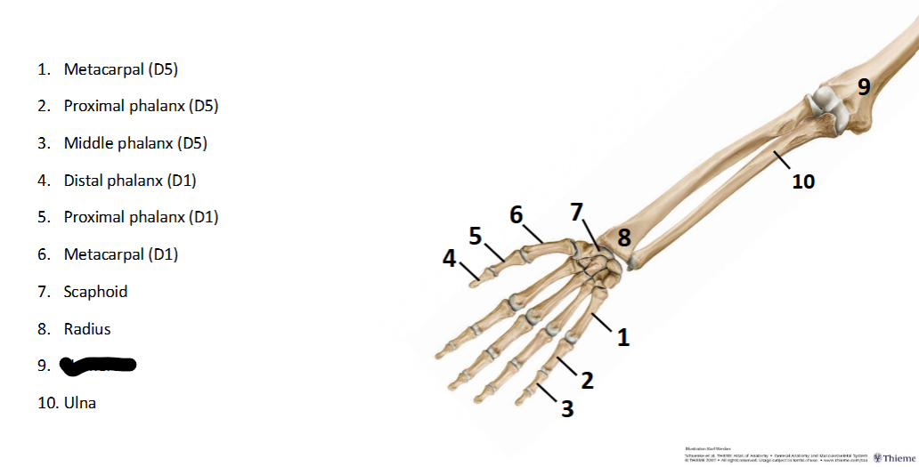 <p>What sturcture is this within the <strong>Upper-Appendicular?</strong></p>