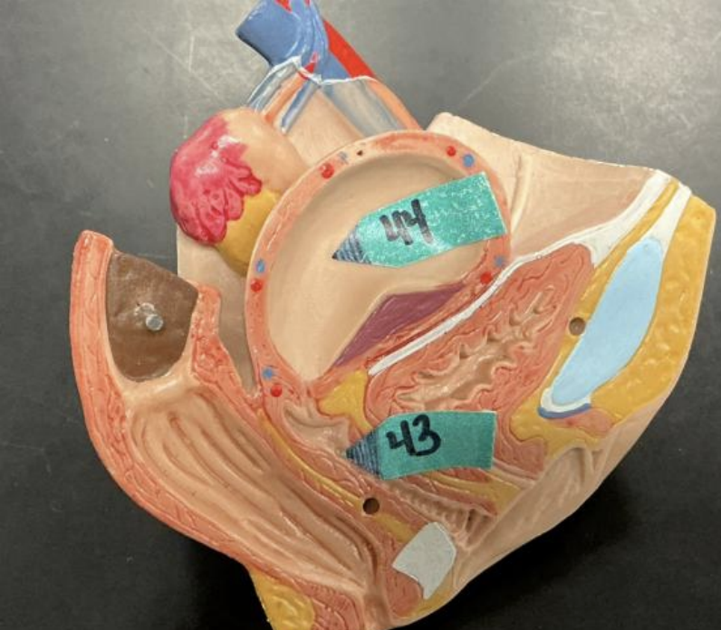 <p>_________ tissue would be located at the end of the pointer labeled 44</p>