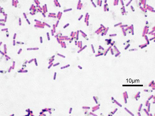 <p>[photo] prokaryotic shape </p>