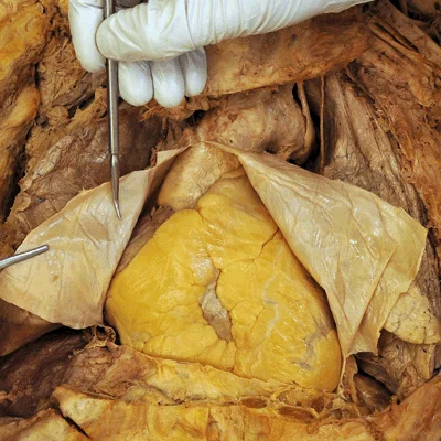 <p>feature</p><p>Shiny part of the flap</p>