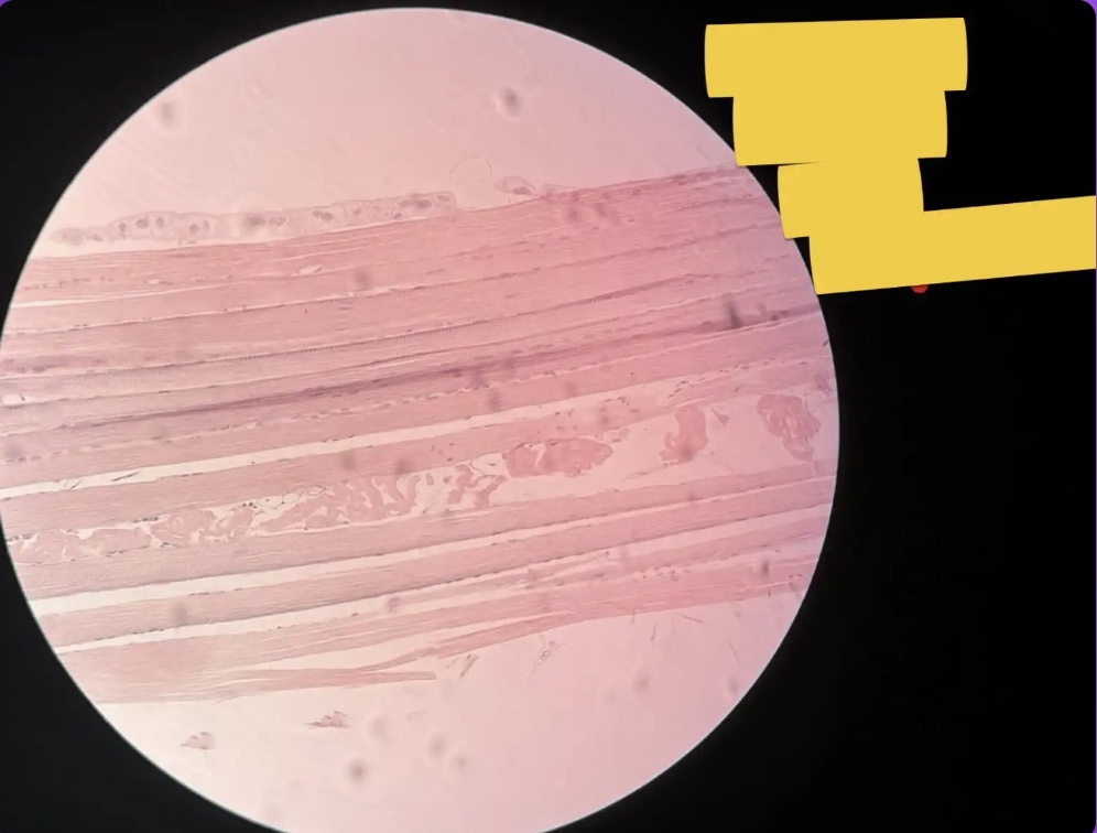 <p>What does the yellow box represent?</p>