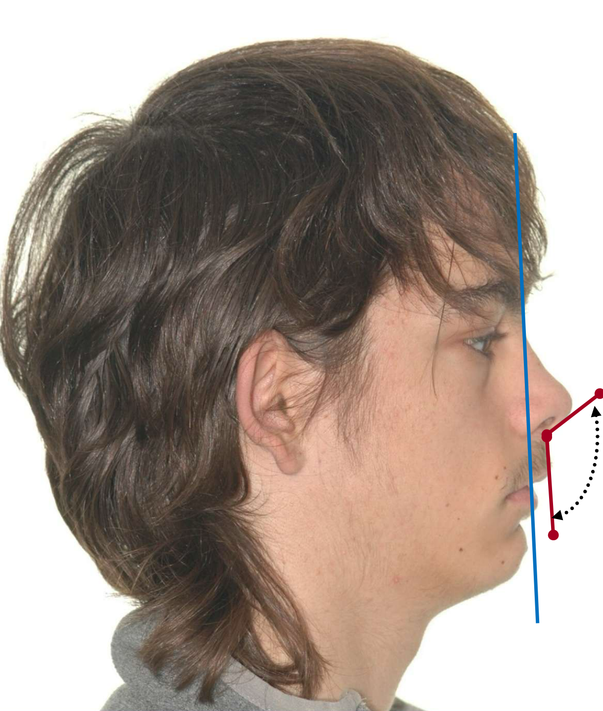 <p>for men a strong projection is </p>