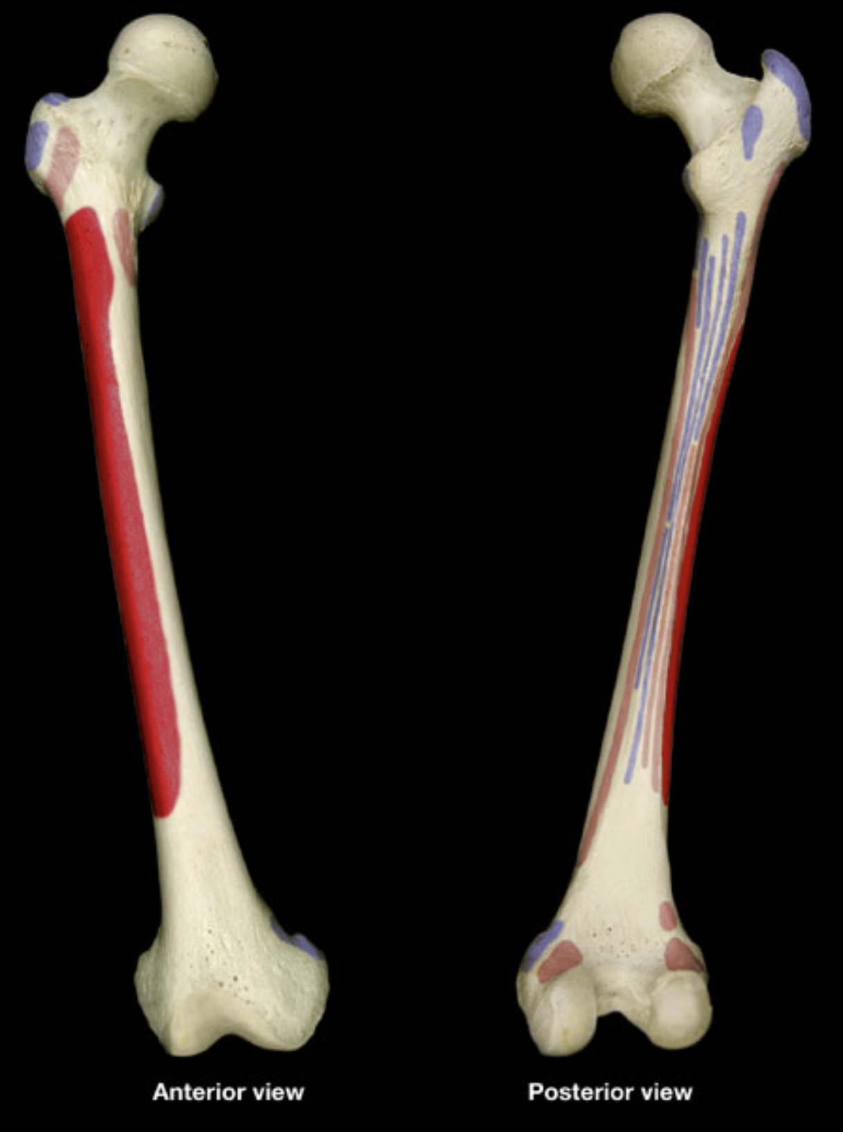 <p>lateral shaft of femur (anterior)</p>