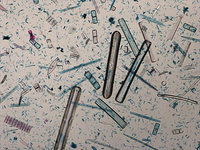 <ul><li><p>aquatic photosynthesizers (phytoplankton)</p></li><li><p>cell walls of silica (glass)</p></li></ul><p></p>