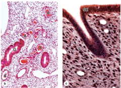 <p>What type of epithelium lines the endometrium?</p>