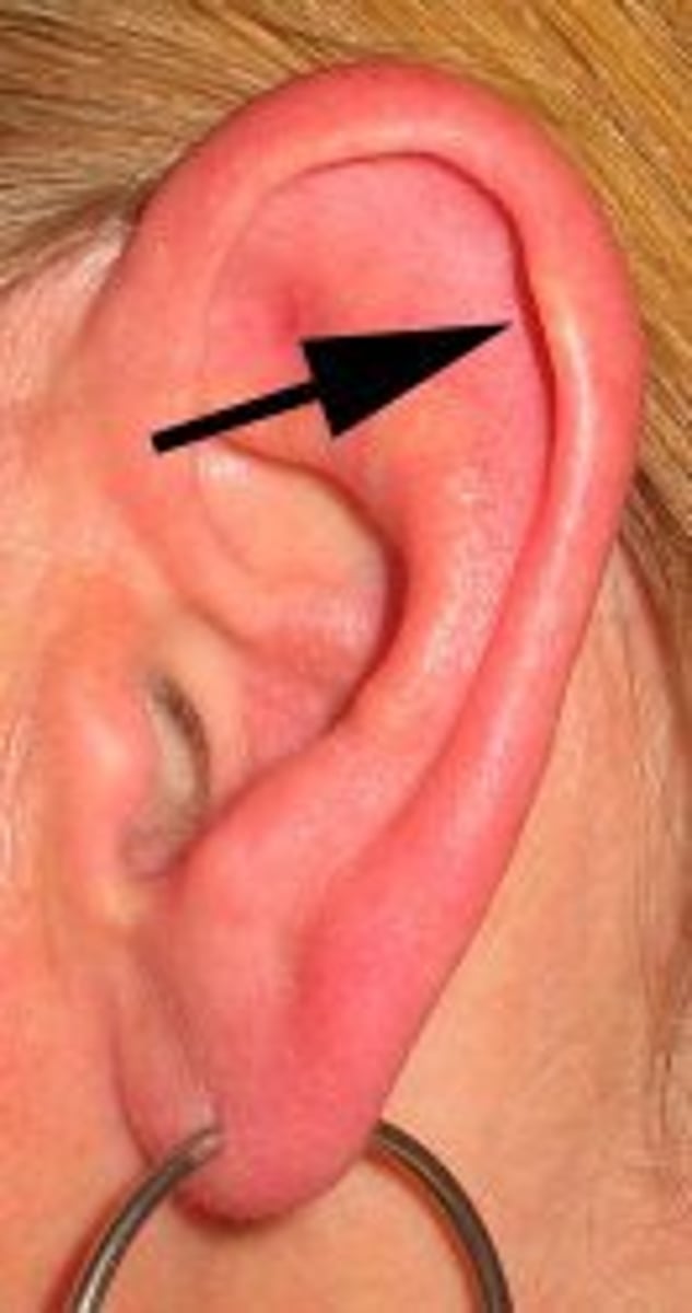 <p>rim of the outside</p><p>part of the auricle</p>