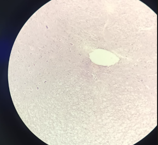 <p>Ganglion Spinale - HE</p><ul><li><p><strong>Neurons:</strong> Contains <strong>pseudounipolar neurons</strong> (T-shaped neurons).</p></li><li><p><strong>Satellite Cells:</strong> Neuron bodies are surrounded by a "<strong>mud-like</strong>" layer of <strong>satellite cells</strong> for protection/trophic function.</p></li><li><p><strong>Note:</strong> There are <strong>no synapses</strong> in this structure; the description is identical for both HE and Silver slides.</p></li></ul><p></p>