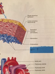 <p>Trabeculae carneae</p>