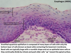 <p>Epithelial tissue. Tightly packed cells. Top layers are flat cells.</p>