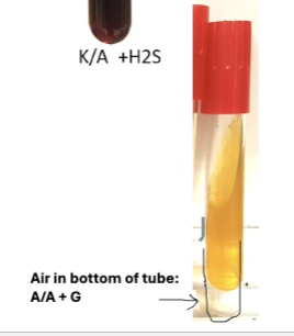<p>Yes we can tell if there are cracks in agar, or agar is pushed up from bottom of tube</p>