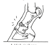 <p>How do you treat a horse for proximal interphalangeal (pastern) joint OA?</p>