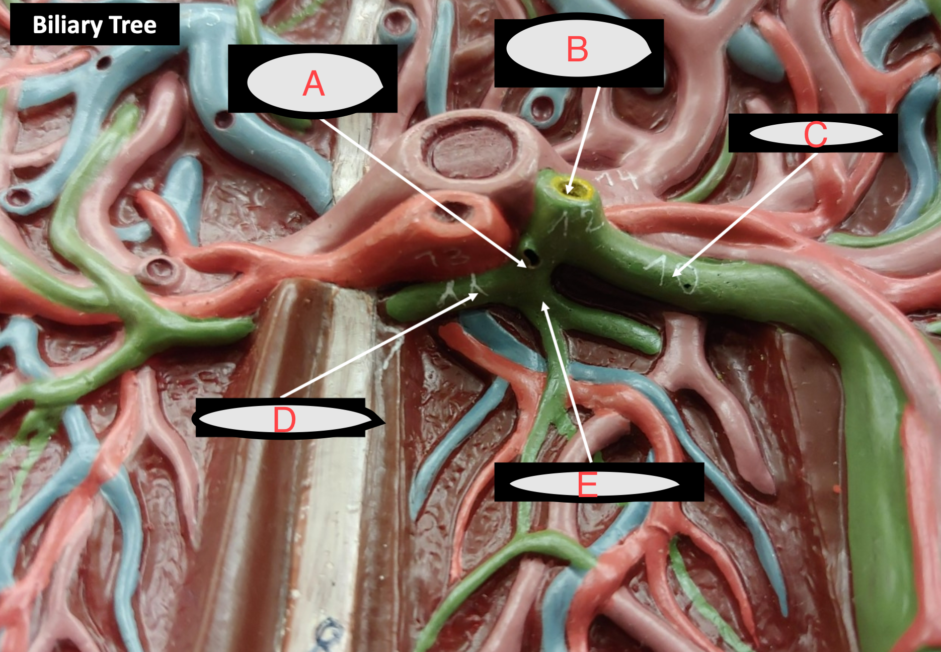 <p>what’s labeled</p>