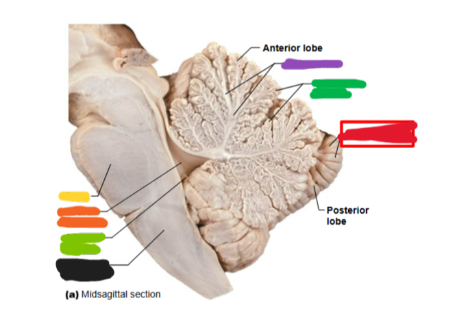 <p>What is this an image of? Name all of the highlighted parts</p>