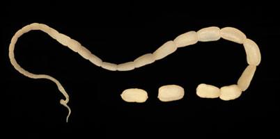 <p>What adult tapeworm is this?</p>
