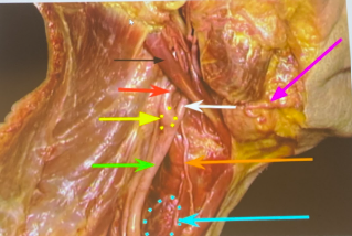 <p>Muscle far behind the black, red, yellow, green arrows: </p><p>Muscle right behind black/red/yellow/green arrows: s</p><p>Green arrow:</p><p>Yellow circle:</p><p>Red arrow: </p><p>White arrow: </p><p>Orange arrow: </p><p>Blue circle: </p><p>Muscle next to pink arrow: </p><p>Black arrow: </p><p>Muscle to the right of the digastric muscle that joins: </p><p>Together if you keep going to the right = </p><p>Pink arrow: </p><p>Bulb under the facial artery: </p>