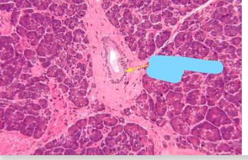 <p>Identify this part of the pancreas </p>