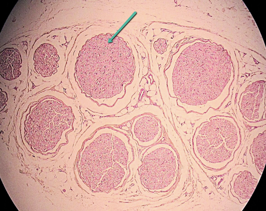 <p><span>Identify the entire dark, round structure indicated by the pointer.</span></p>