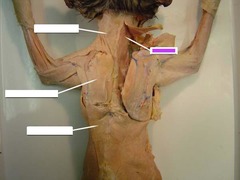 <p>muscle that serves to turn or raise the head</p>