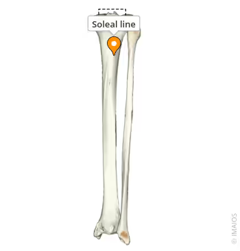 <p>Soleal line </p>