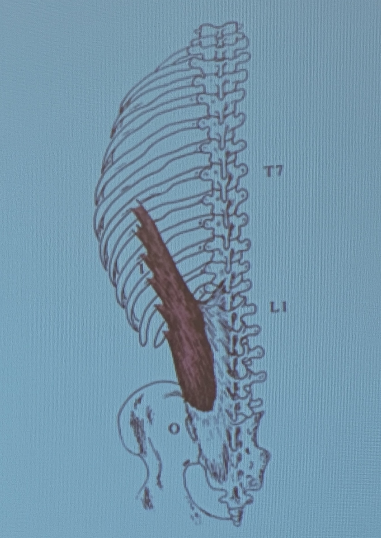 <p>Muscle name?</p>