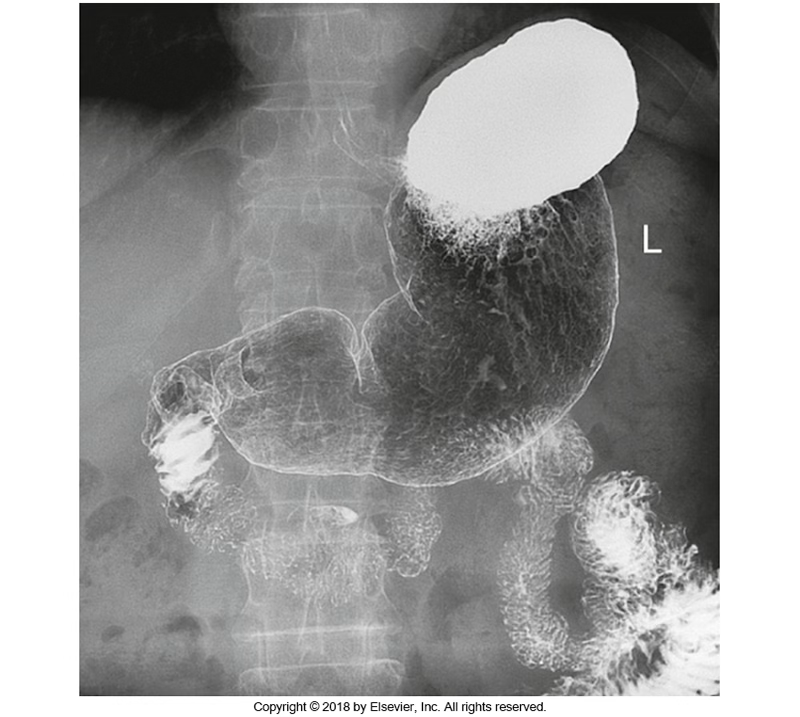<p>Which position was this patient in?</p>
