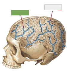 <p>This is the</p>