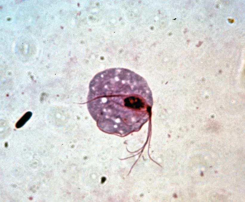 <p>What group does <em>Trichomonas vaginalis</em> belong to?</p>