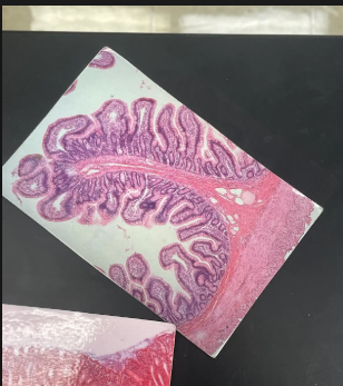 <p> Mucosa</p><ul><li><p>Simple columnar epithelium & goblet cells</p></li><li><p>Villi & Microvilli</p></li></ul><p>Submucosa</p><ul><li><p>Plicae circulares in some preparations</p></li></ul><p>Muscularis: Smooth muscle (2 layers)</p><p>Serosa</p>