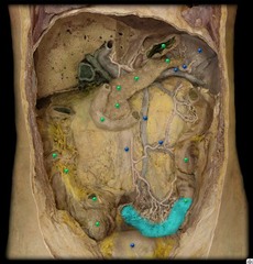 <p>identify the structure</p>