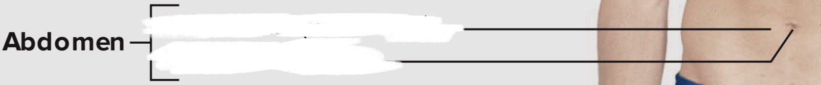 <p>Abdomen</p>