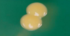 <ul><li><p>round, </p></li><li><p>smooth, </p></li><li><p>opaque,</p></li><li><p>butyrous</p></li></ul><p></p>