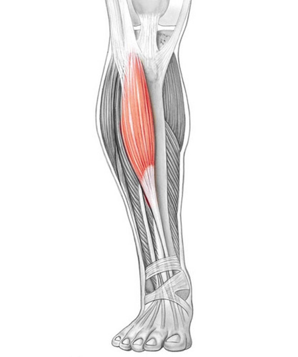 <p>Tibialis Anterior</p>