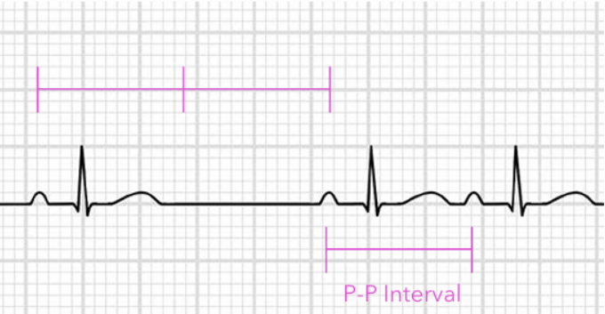 <p>The underlying mechanism for this is a conduction issue</p>