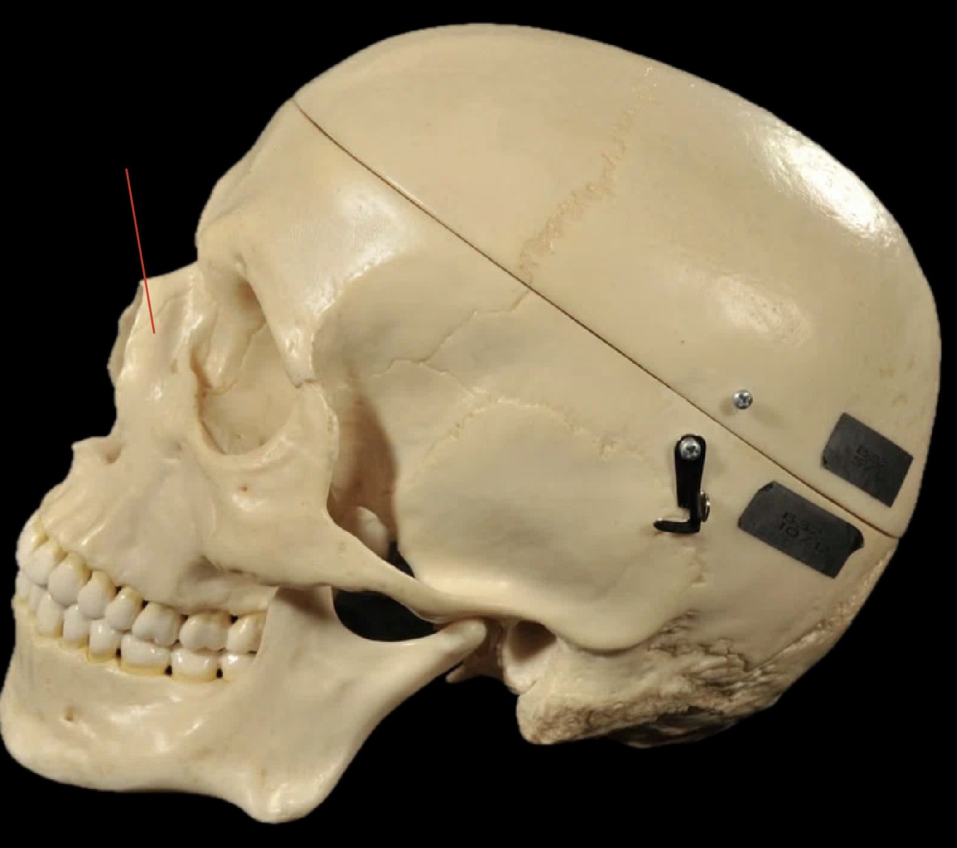 <p>What bones are these?</p>