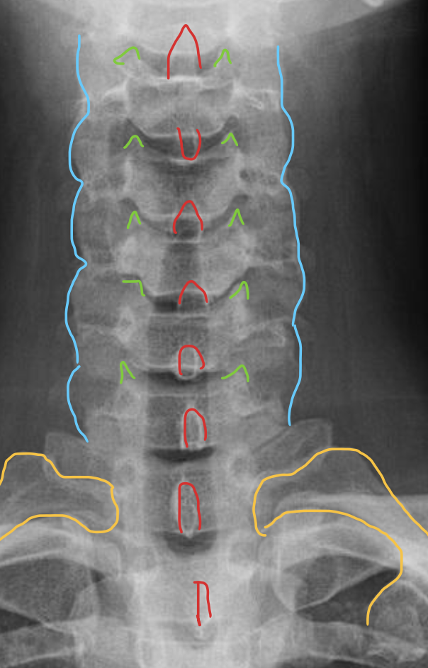 <p><span>关节柱 / 侧块</span></p>