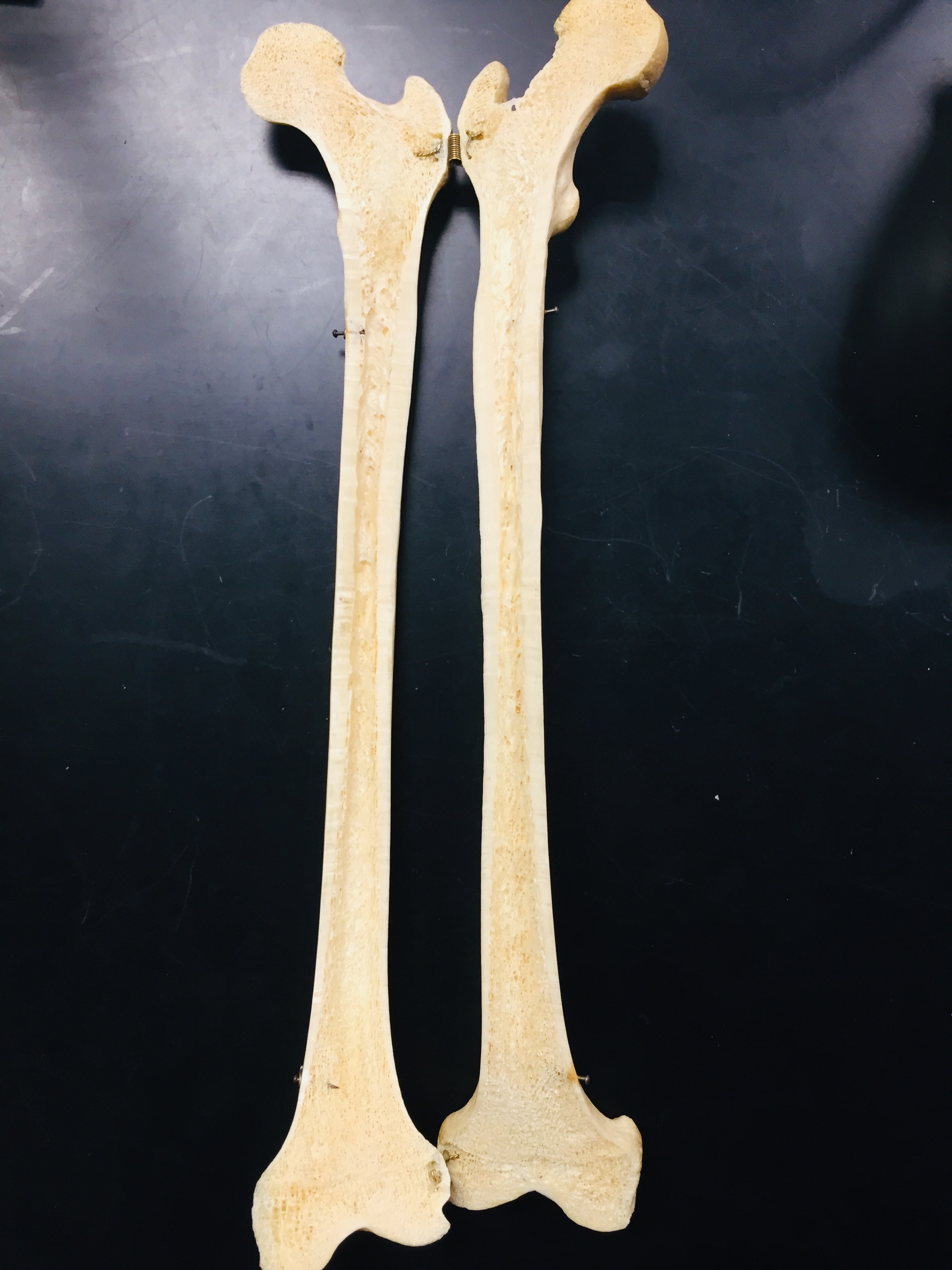 <p>name bone and structures</p>