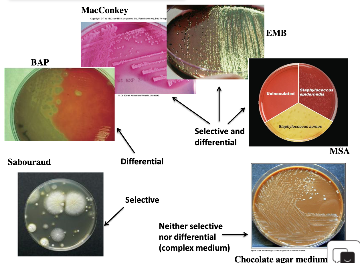 <ul><li><p>Quadrant streaking technique→ help separate species to detect the colonies of a pathogen</p></li><li><p>Serial Dilutions → Pour plates → Spread Plate Methods</p></li><li><p><strong>MacConkey agar (MAC)</strong> → Selects for <strong>Gram-negative bacteria</strong> and differentiates <strong>lactose fermenters</strong>.</p><ul><li><p><span data-name="pink_heart" data-type="emoji">🩷</span> Pink colonies = lactose fermenter</p></li><li><p>Example: <em>E. coli</em></p></li></ul></li><li><p><strong>Mannitol Salt Agar (MSA)</strong> → Selects for <strong>salt-tolerant bacteria</strong>, especially <strong>Staphylococcus</strong>, and differentiates <strong>mannitol fermentation</strong>.</p><ul><li><p><span data-name="yellow_circle" data-type="emoji">🟡</span> Yellow = mannitol fermenter</p></li><li><p>Example: <em>S. aureus</em></p></li></ul></li><li><p><strong>Blood Agar Plate (BAP)</strong> → <strong>Enriched and differential</strong> medium used to observe <strong>hemolysis</strong>.</p></li></ul><p></p><p><strong>MAC → Gram − + lactose</strong><br><strong>MSA → Staph + mannitol</strong><br><strong>BAP → Blood + hemolysis</strong></p>
