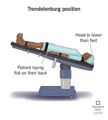 <p>Trendelenburg position?</p>