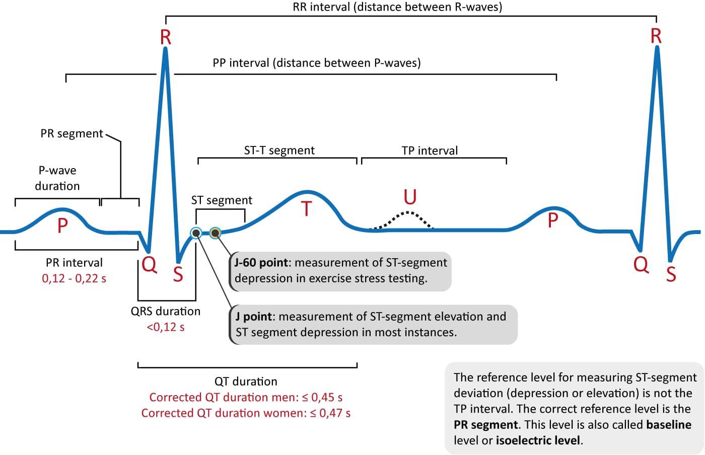 <ul><li><p>the first downward deflection of QRS Complex</p></li><li><p>normal electrical activation, hearts middle wall</p></li></ul><p></p>