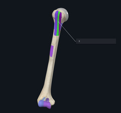 <p>Name the boney landmark indicated by the X and highlighted purple</p>
