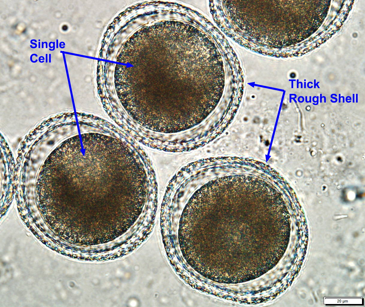 <p>toxocara canis</p>