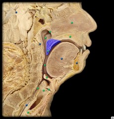 <p>muscular posterior (back) portion of the palate</p>
