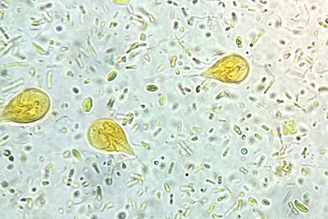 <p>Giardia</p>
