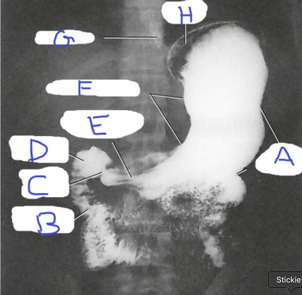 <p>Label this radiograph A-H. For I- state the position J- state how you know</p>