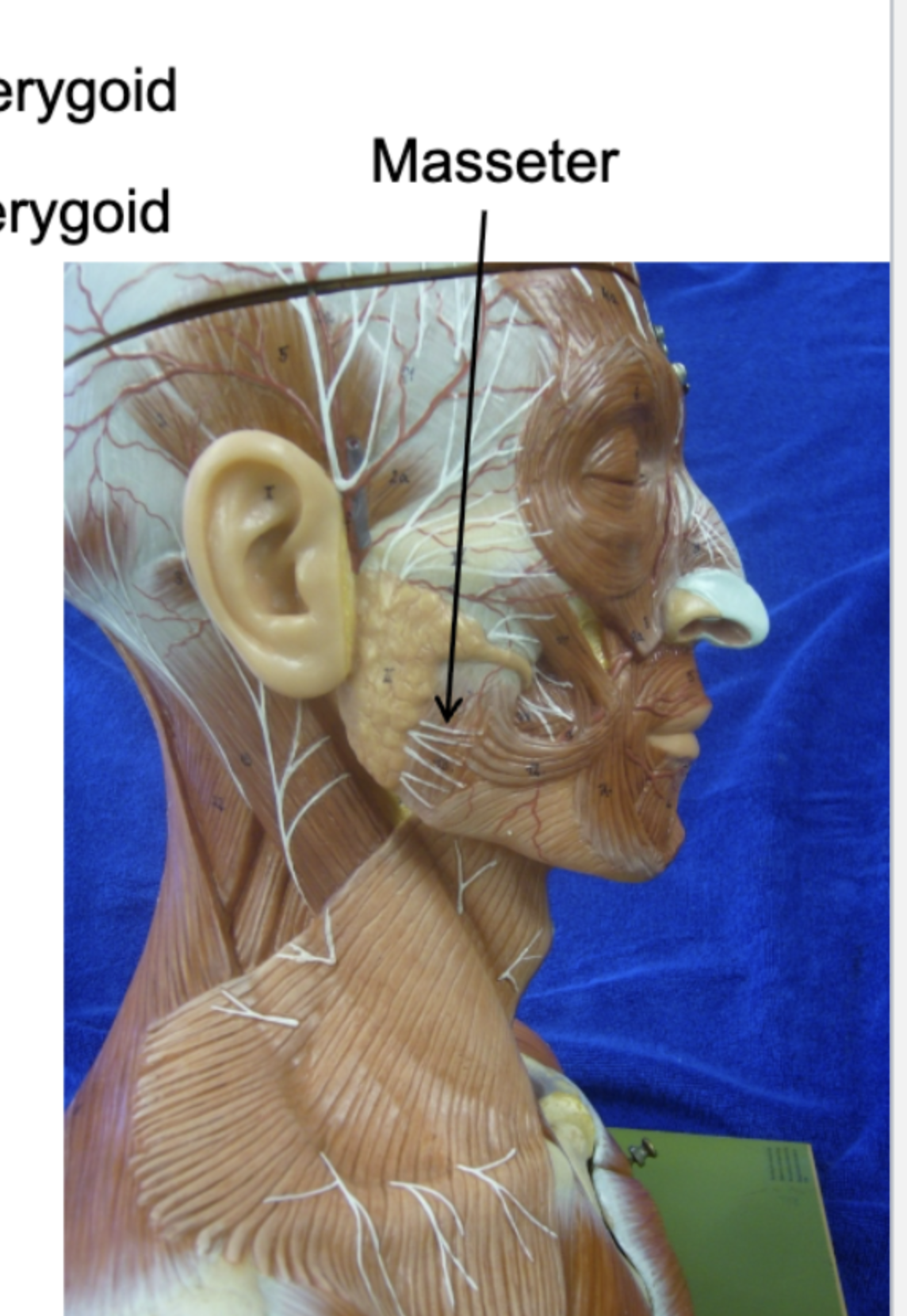 <p>the thick, rectangular muscle on the side of the face that connects the cheekbone to the lower jaw</p>
